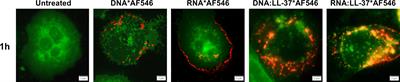 Complexation of fungal extracellular nucleic acids by host LL-37 peptide shapes neutrophil response to Candida albicans biofilm